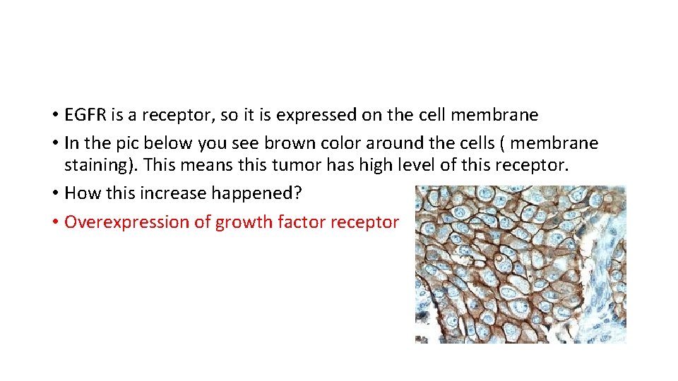  • EGFR is a receptor, so it is expressed on the cell membrane