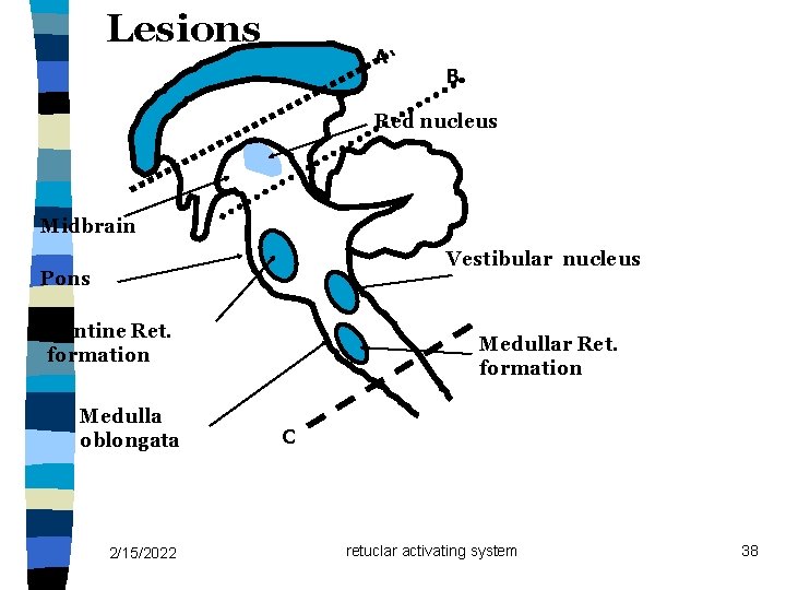 Lesions A B Red nucleus Midbrain Vestibular nucleus Pontine Ret. formation Medulla oblongata 2/15/2022