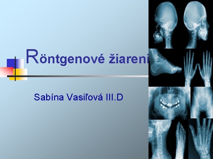 Röntgenové žiarenie Sabína Vasiľová III. D 