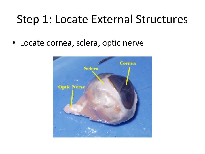 Step 1: Locate External Structures • Locate cornea, sclera, optic nerve Step 1: Locate External Structures • Locate cornea, sclera, optic nerve