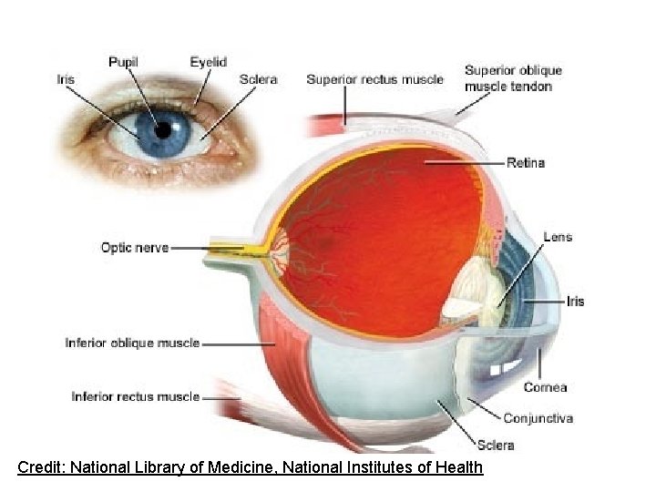 Credit: National Library of Medicine, National Institutes of Health Credit: National Library of Medicine, National Institutes of Health