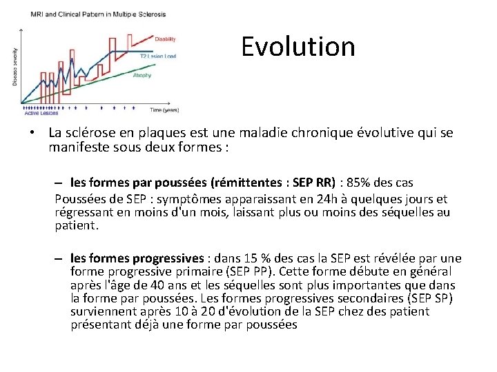 Evolution • La sclérose en plaques est une maladie chronique évolutive qui se manifeste