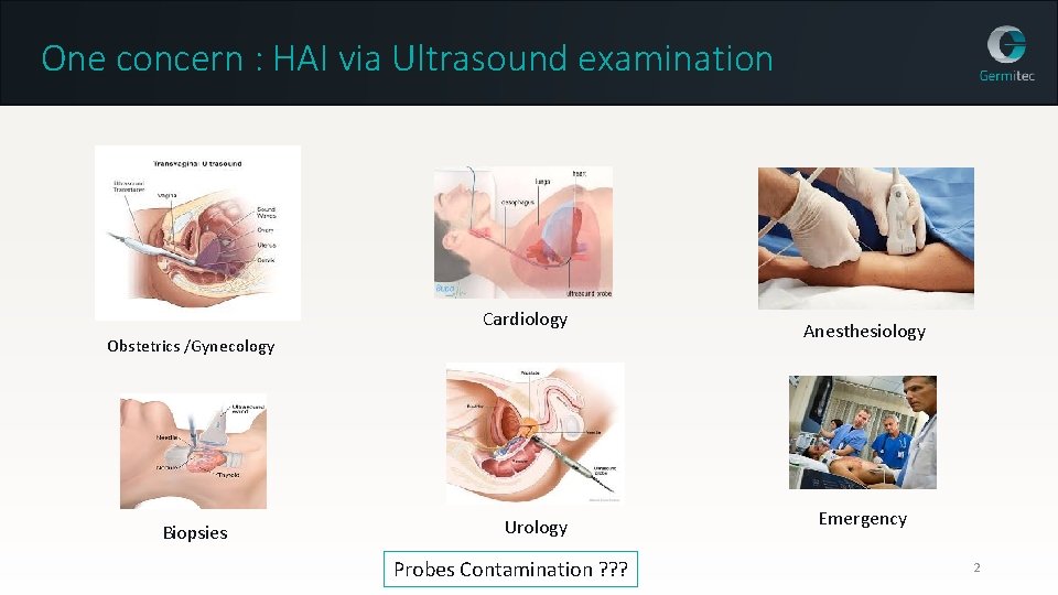 One concern : HAI via Ultrasound examination Cardiology Obstetrics /Gynecology Biopsies Urology Probes Contamination
