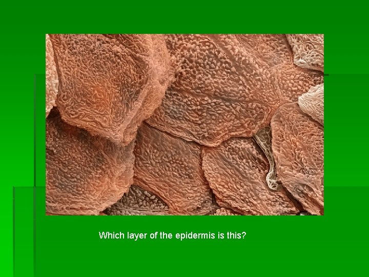 Which layer of the epidermis is this? 