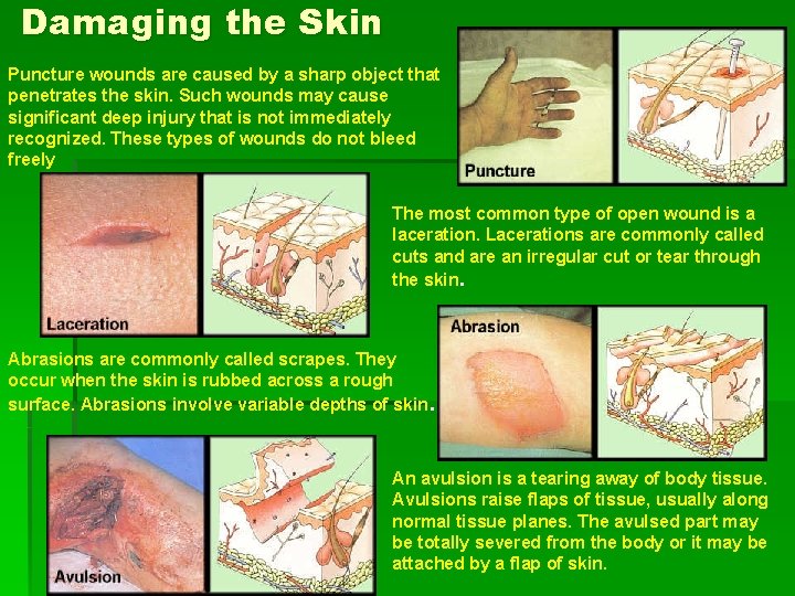 Damaging the Skin Puncture wounds are caused by a sharp object that penetrates the