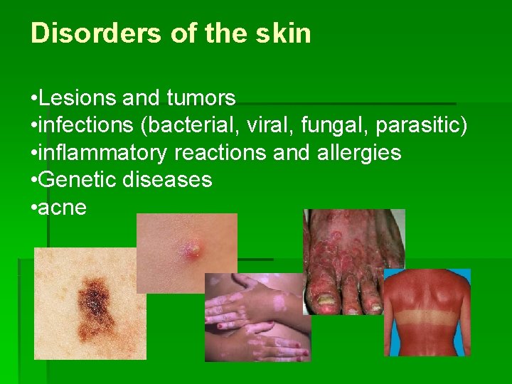 Disorders of the skin • Lesions and tumors • infections (bacterial, viral, fungal, parasitic)