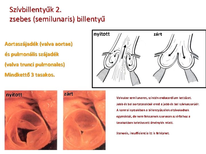 Szívbillentyűk 2. zsebes (semilunaris) billentyű nyitott zárt Aortaszájadék (valva aortae) és pulmonális szájadék (valva