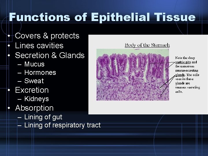 Functions of Epithelial Tissue • Covers & protects • Lines cavities • Secretion &