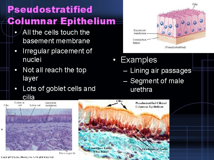 Pseudostratified Columnar Epithelium • All the cells touch the basement membrane • Irregular placement