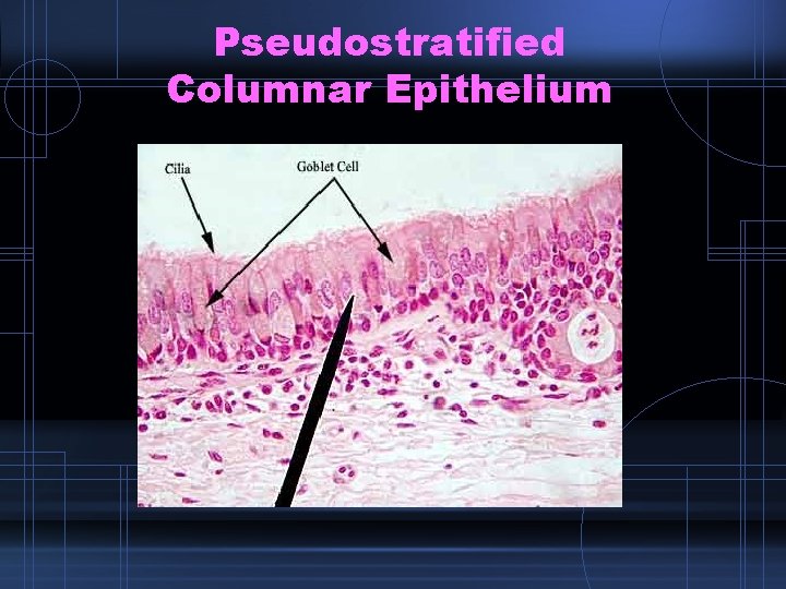 Pseudostratified Columnar Epithelium 