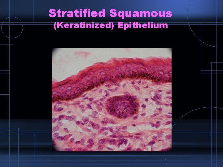 Stratified Squamous (Keratinized) Epithelium 