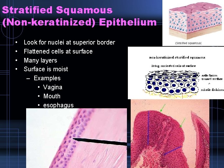 Stratified Squamous (Non-keratinized) Epithelium • • Look for nuclei at superior border Flattened cells