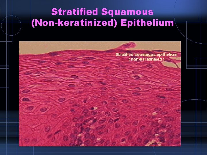 Stratified Squamous (Non-keratinized) Epithelium 