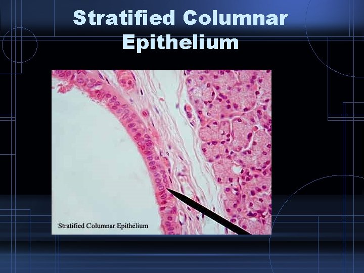 Stratified Columnar Epithelium 
