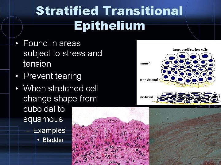 Stratified Transitional Epithelium • Found in areas subject to stress and tension • Prevent