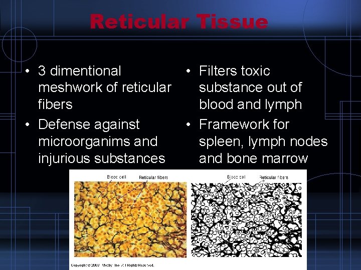 Reticular Tissue • 3 dimentional • Filters toxic meshwork of reticular substance out of
