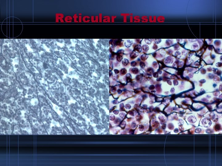 Reticular Tissue 