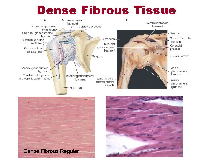 Dense Fibrous Tissue Dense Fibrous Regular 