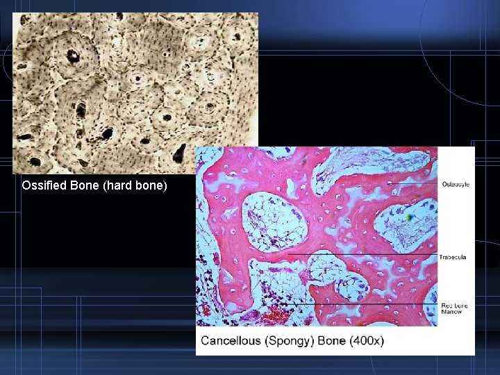Cancellous Bone (spongy bone) Ossified Bone (hard bone) 