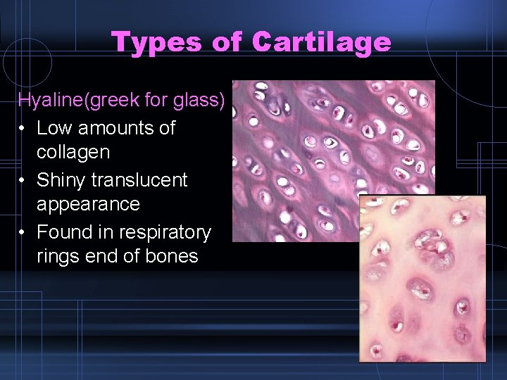 Types of Cartilage Hyaline(greek for glass) • Low amounts of collagen • Shiny translucent