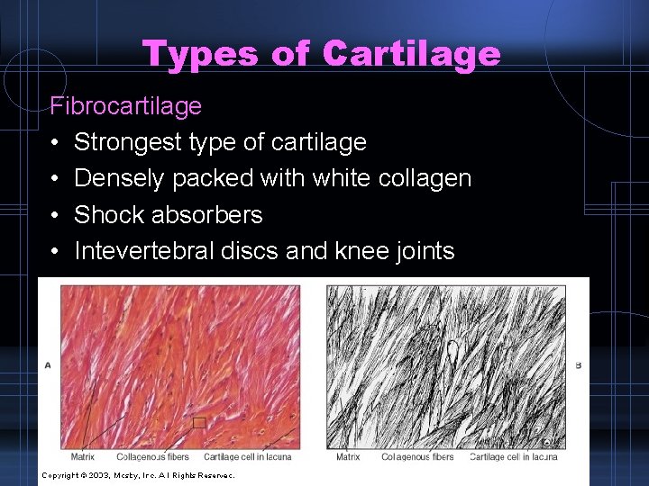 Types of Cartilage Fibrocartilage • Strongest type of cartilage • Densely packed with white