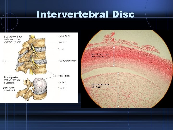 Intervertebral Disc 
