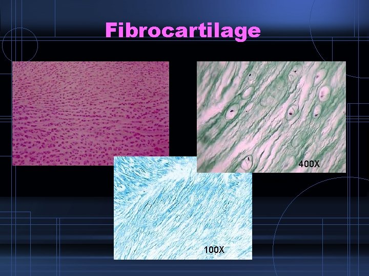 Fibrocartilage 400 X Dense Fibrous Connective 100 X 