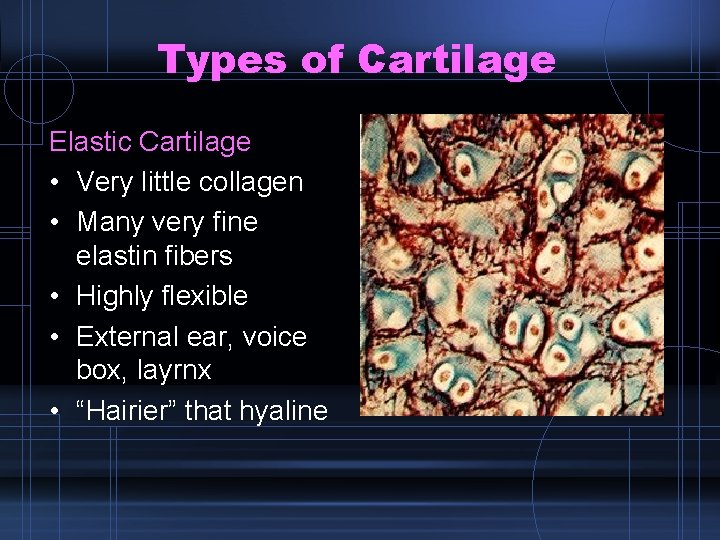 Types of Cartilage Elastic Cartilage • Very little collagen • Many very fine elastin