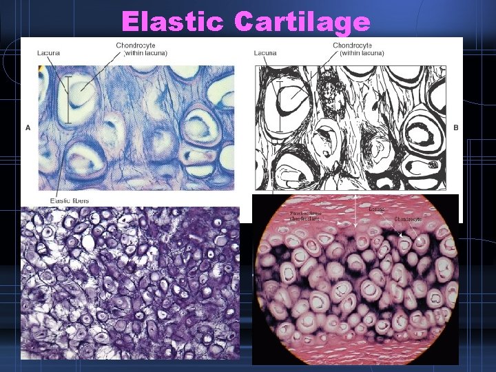 Elastic Cartilage 