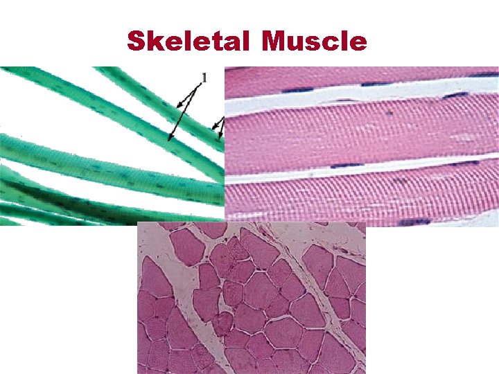 Skeletal Muscle 