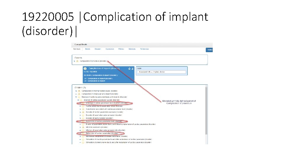 19220005 |Complication of implant (disorder)| 