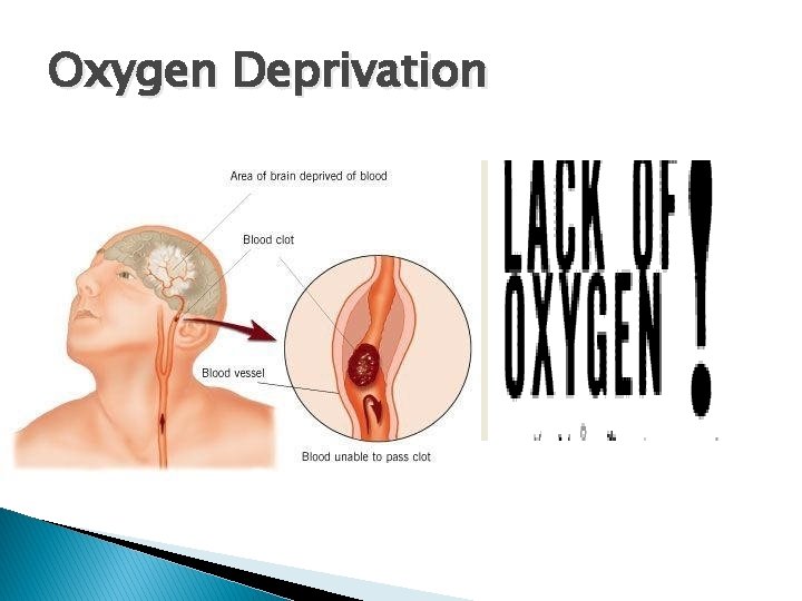 Oxygen Deprivation 