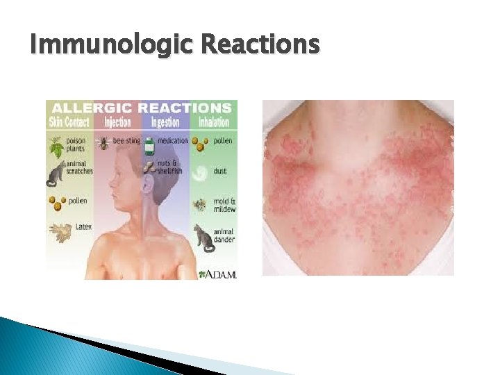 Immunologic Reactions 