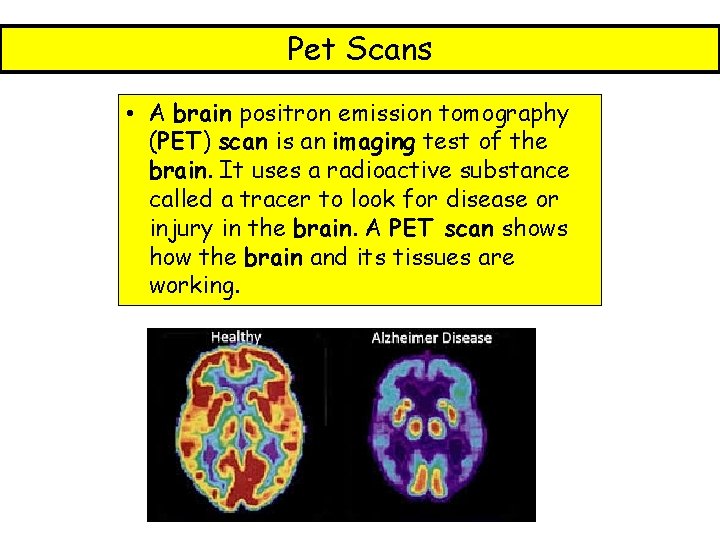 Pet Scans • A brain positron emission tomography (PET) scan is an imaging test