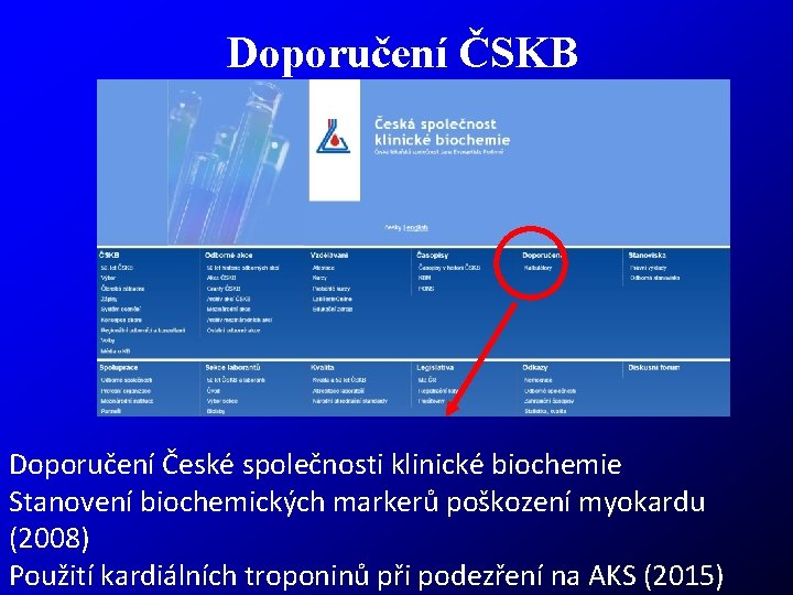 Doporučení ČSKB Doporučení České společnosti klinické biochemie Stanovení biochemických markerů poškození myokardu (2008) Použití