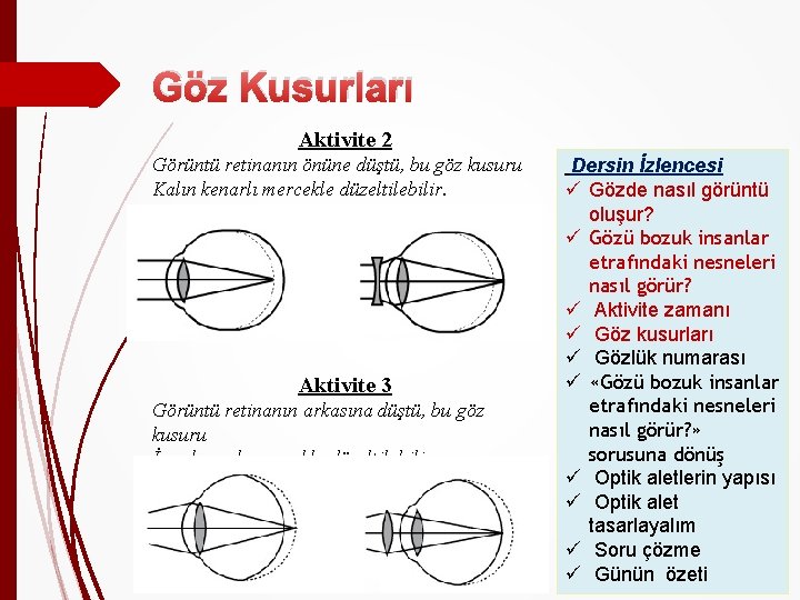 Göz Kusurları Aktivite 2 Görüntü retinanın önüne düştü, bu göz kusuru Kalın kenarlı mercekle