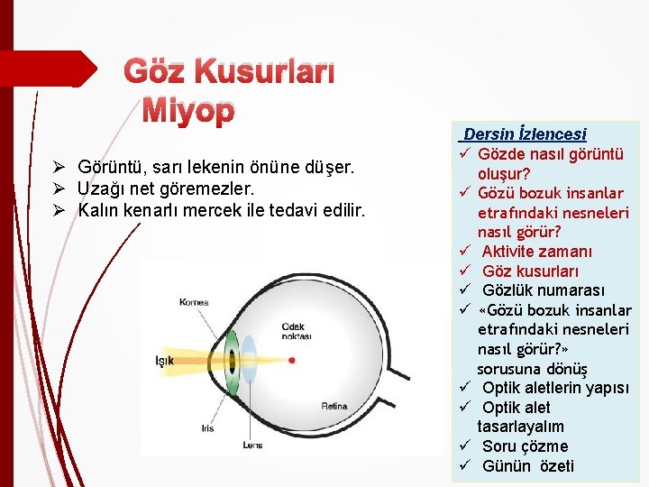 Göz Kusurları Miyop Ø Görüntü, sarı lekenin önüne düşer. Ø Uzağı net göremezler. Ø