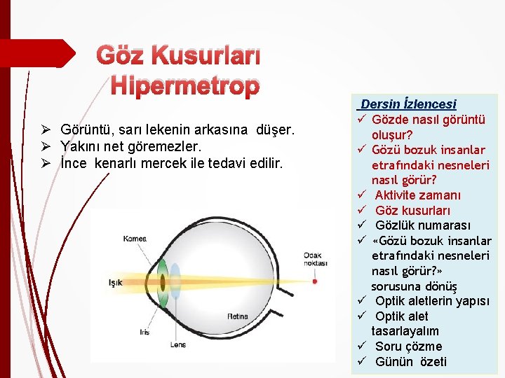 Göz Kusurları Hipermetrop Ø Görüntü, sarı lekenin arkasına düşer. Ø Yakını net göremezler. Ø