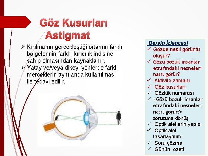 Göz Kusurları Astigmat Ø Kırılmanın gerçekleştiği ortamın farklı bölgelerinin farklı kırıcılık indisine sahip olmasından