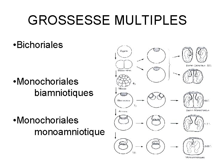 GROSSESSE MULTIPLES • Bichoriales • Monochoriales biamniotiques • Monochoriales monoamniotiques 