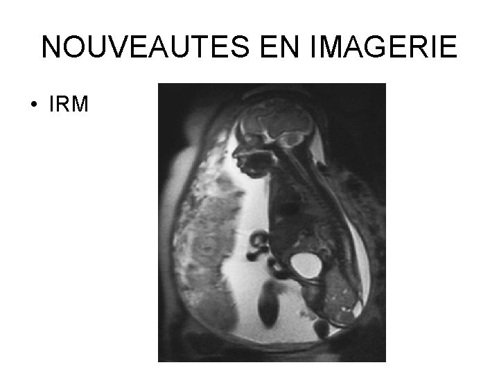 NOUVEAUTES EN IMAGERIE • IRM 