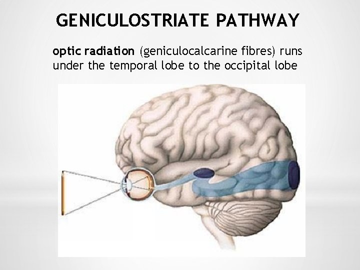 GENICULOSTRIATE PATHWAY optic radiation (geniculocalcarine fibres) runs under the temporal lobe to the occipital
