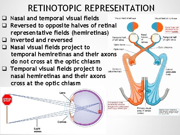 RETINOTOPIC REPRESENTATION q Nasal and temporal visual fields q Reversed to opposite halves of