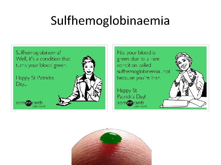 Sulfhemoglobinaemia 