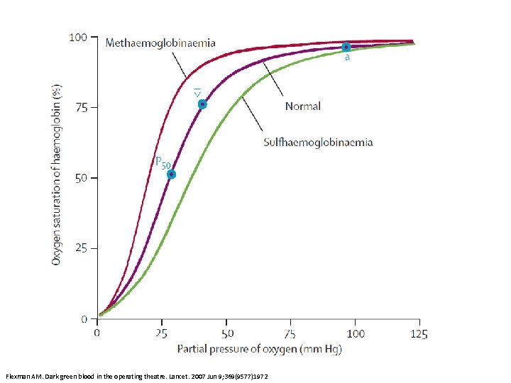 Flexman AM. Dark green blood in the operating theatre. Lancet. 2007 Jun 9; 369(9577)1972