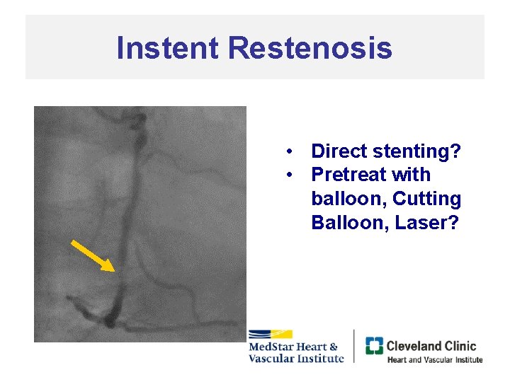 Instent Restenosis • Direct stenting? • Pretreat with balloon, Cutting Balloon, Laser? 