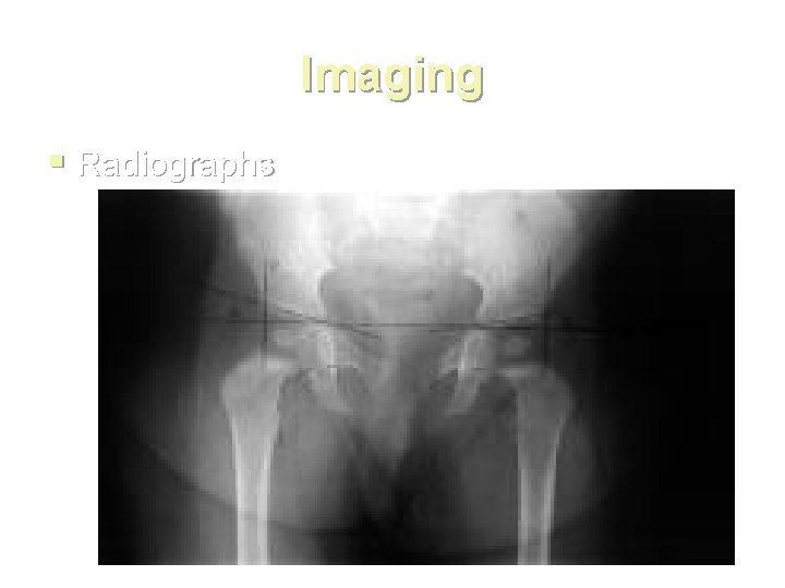 Imaging § Radiographs 