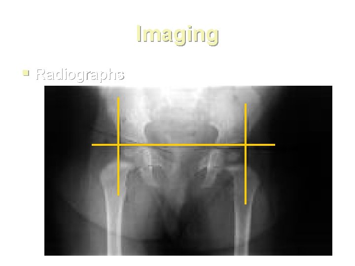 Imaging § Radiographs 