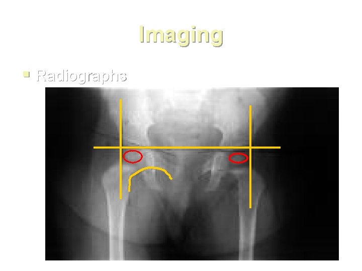 Imaging § Radiographs 
