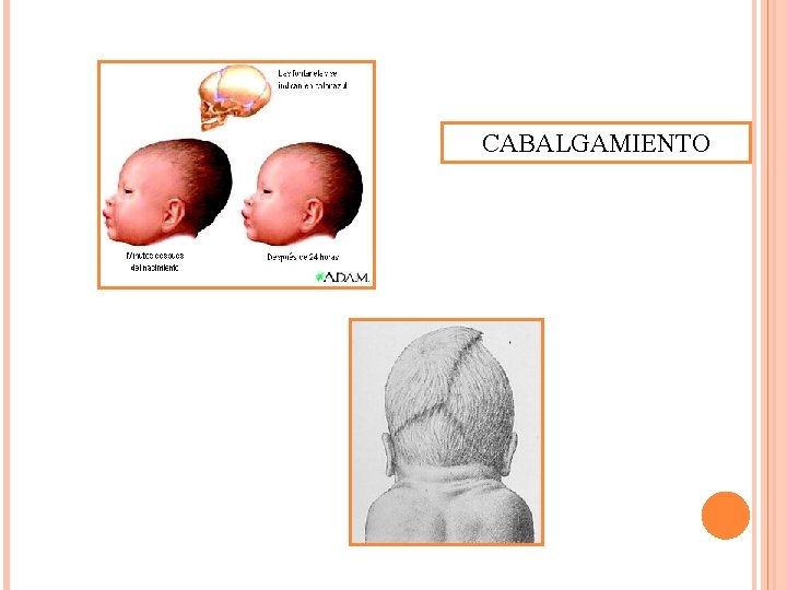 CABALGAMIENTO 